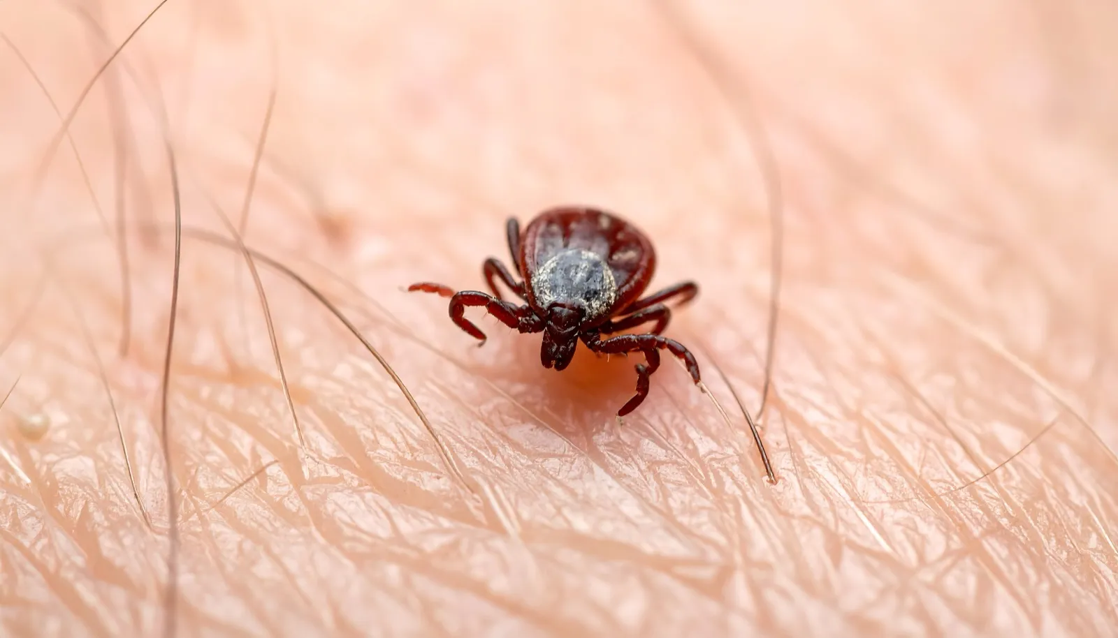 A tick attached to human skin